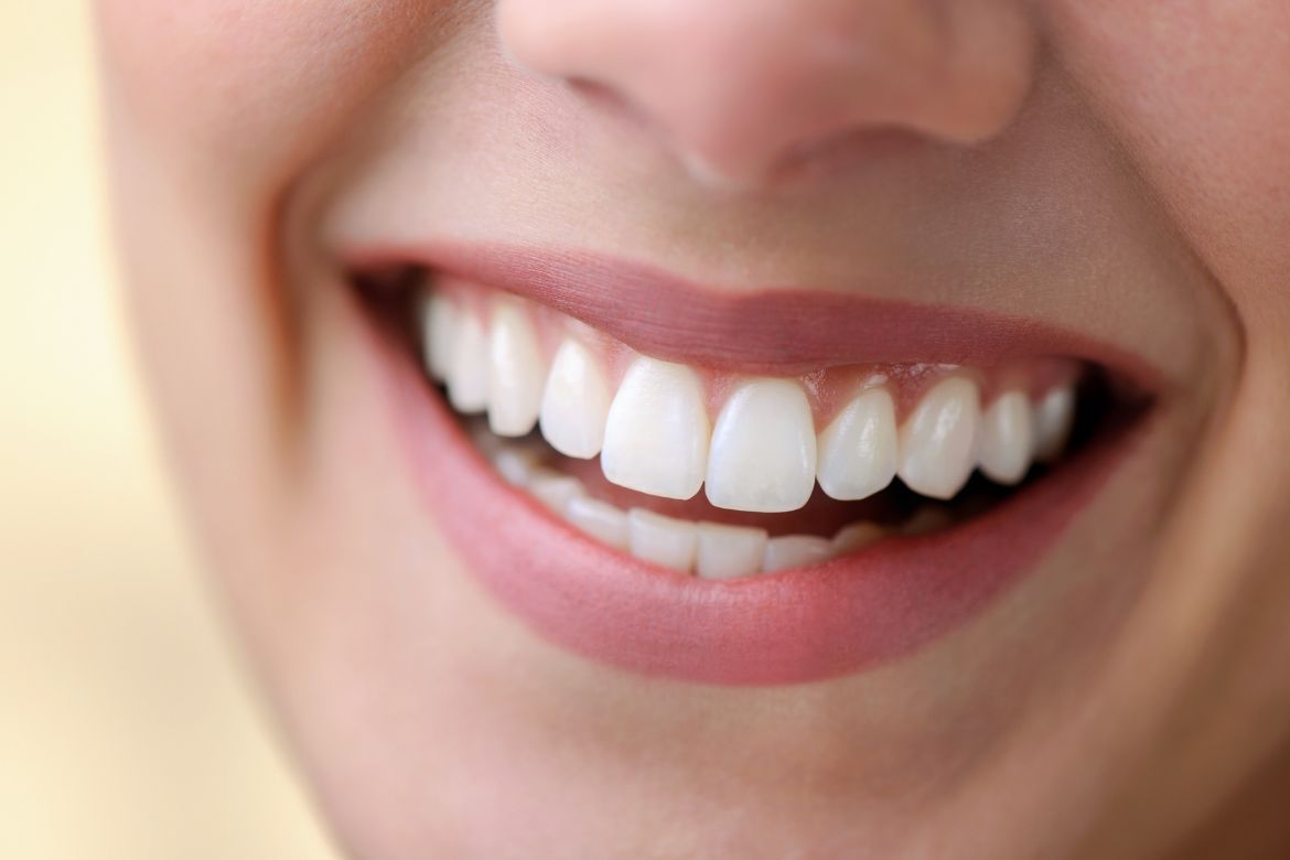 Can You Get the Perfect Smile Without Braces?